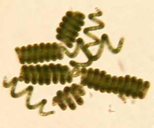 Premières observations de la spiruline au microscope